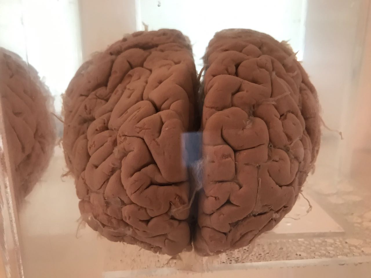 Fotografía ilustrativa de cerebro
