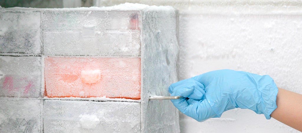 Plasma Biobank