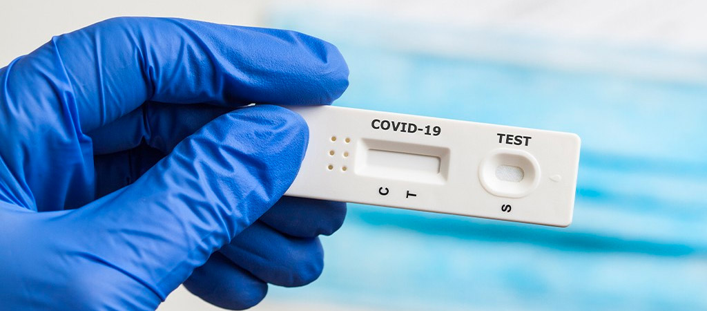 Identificación Test y pruebas rápidas para detección de COVID-19