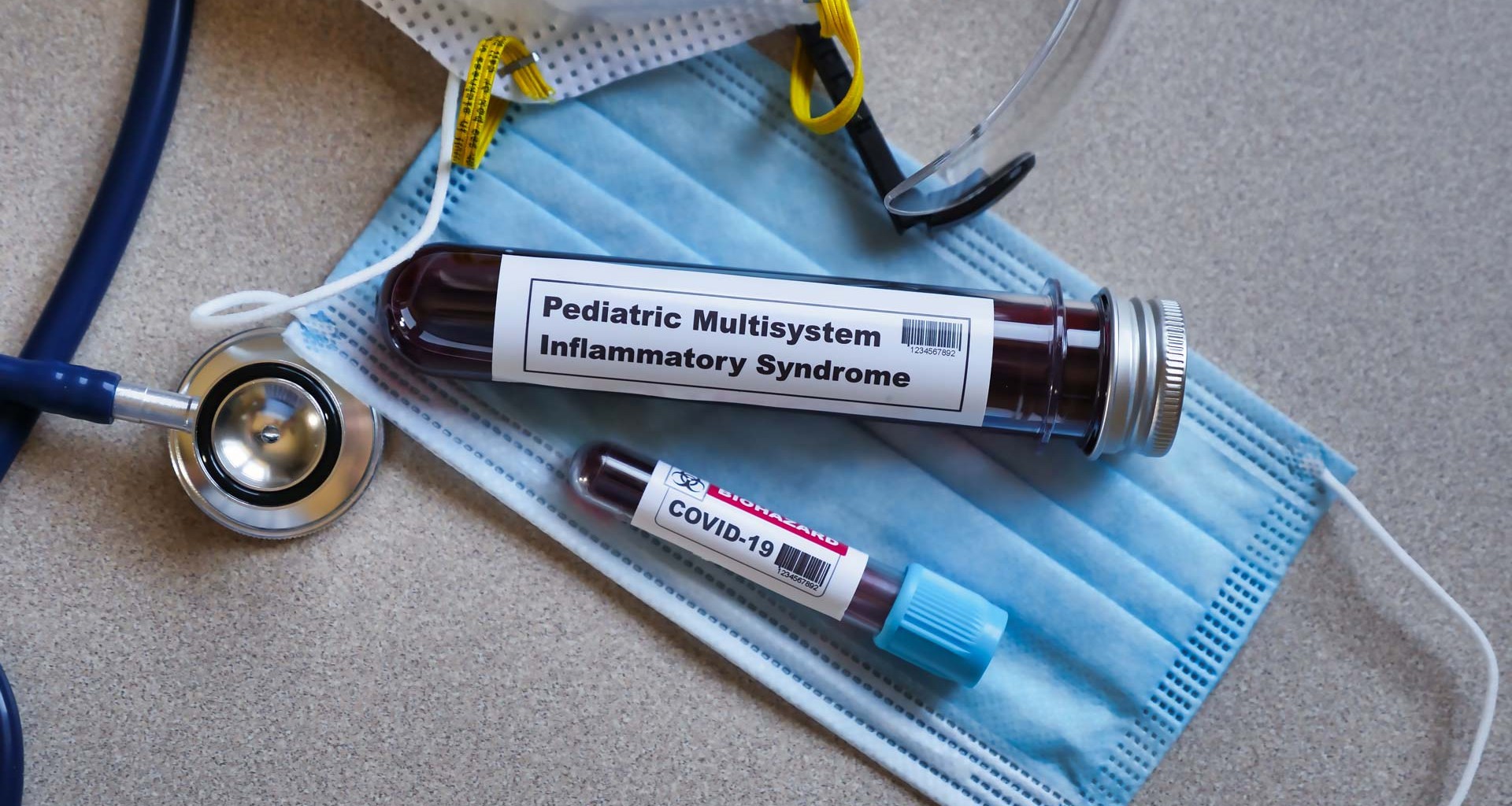 Síndrome inflamatorio multisistémico pediátrico, sus síntomas, lo que hay que decirle al médico. Señales de alerta